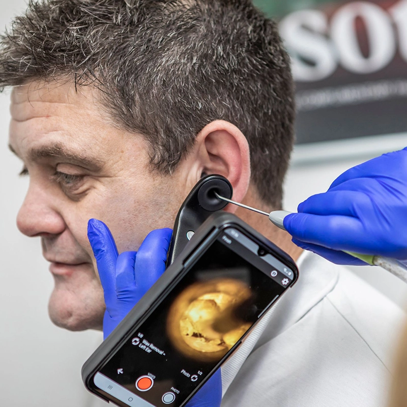 Patient having earwax removal with microsuction